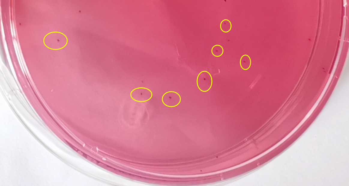VRBA內(nèi)的紅色小菌落，有可能是沙門氏菌？